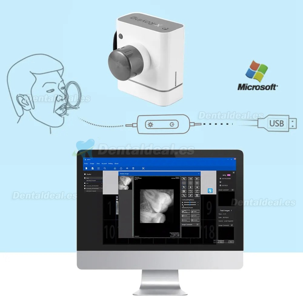 Sensor de Rayos X de Imagen Digital Dental RVG Sistema de Imágenes Intraorales Dentales